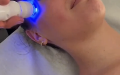 Arriva XFORMER: la nuova tecnologia per viso e corpo!